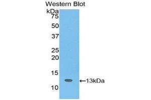 Western Blotting (WB) image for anti-Slit Homolog 3 (SLIT3) (AA 62-119) antibody (ABIN1176113) (SLIT3 抗体  (AA 62-119))