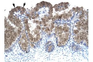 ASGR2 antibody was used for immunohistochemistry at a concentration of 4-8 ug/ml to stain Epithelial cells of intestinal villus (arrows) in Human Intestine. (Asialoglycoprotein Receptor 2 抗体  (N-Term))