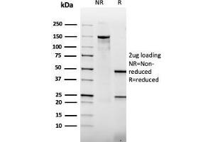 SDS-PAGE Analysis Purified Thrombomodulin Mouse Recombinant Monoclonal Antibody (rTHBD/1591). (Recombinant Thrombomodulin 抗体  (AA 69-194))