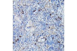 Immunohistochemistry of paraffin-embedded rat spleen using DDIT3/CHOP Rabbit pAb (ABIN6131562, ABIN6139460, ABIN6139463 and ABIN6215170) at dilution of 1:200 (40x lens). (DDIT3 抗体  (AA 1-169))