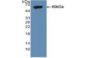 Detection of Recombinant SORT1, Human using Polyclonal Antibody to Sortilin 1 (SORT1) (Sortilin 1 抗体  (AA 50-320))