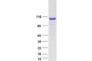 CYLD Protein (Transcript Variant 2) (Myc-DYKDDDDK Tag)