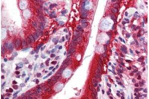 Human Small Intestine: Formalin-Fixed, Paraffin-Embedded (FFPE) (FTO 抗体  (N-Term))