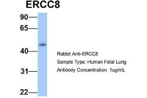 Host:  Rabbit  Target Name:  ERCC8  Sample Type:  Human Fetal Lung  Antibody Dilution:  1. (ERCC8 抗体  (C-Term))