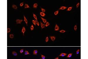 Immunofluorescence analysis of L929 cells using NRP1 Polyclonal Antibody at dilution of 1:100. (Neuropilin 1 抗体)