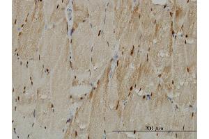 Immunoperoxidase of monoclonal antibody to TTN on formalin-fixed paraffin-embedded human skeletal muscle. (Titin 抗体  (AA 1-110))