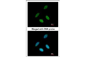 Immunofluorescence analysis of paraformaldehyde-fixed HeLa, using TAP antibody at 1:200 dilution. (NXF1 抗体)