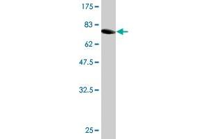 Western Blotting (WB) image for anti-Fumarate Hydratase (FH) (AA 33-510) antibody (ABIN560888)