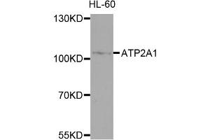 Western blot analysis of extracts of HL-60 cells, using ATP2A1 antibody (ABIN4902981) at 1:1000 dilution. (ATP2A1/SERCA1 抗体)