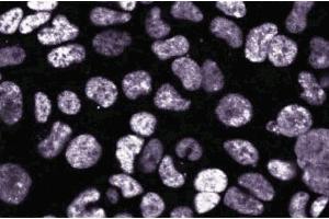 Immunofluoresence staining on 293 cells. (DEK 抗体  (AA 19-169))