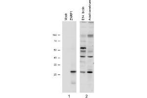 N2a overexpressing Mouse Znrf1 (mock transfection in first lane) and probed with ZNRF1 Antibody   (1µg/ml), also staining of Mouse Brain lysates (Embryo E14 and adult cerebellum). (ZNRF1 抗体)