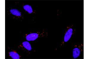 Proximity Ligation Analysis of protein-protein interactions between FGF1 and FGFR1. (FGFR1 抗体  (AA 31-150))