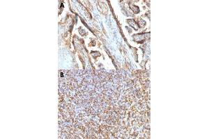 Immunohistochemical staining (Formalin-fixed paraffin-embedded sections) of human placenta (A) and human spleen (B) with LGALS13 monoclonal antibody, clone PP13/1161 . (LGALS13 抗体  (AA 23-134))