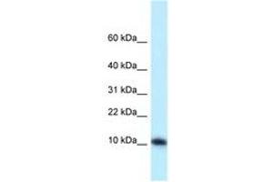 Image no. 1 for anti-Mediator Complex Subunit 21 (MED21) (AA 19-68) antibody (ABIN6747864) (MED21 抗体  (AA 19-68))