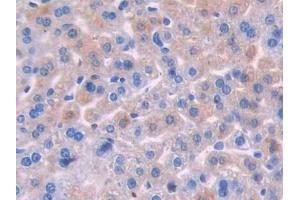 Detection of OSM in Mouse Liver Tissue using Polyclonal Antibody to Oncostatin M (OSM) (Oncostatin M 抗体  (AA 116-205))