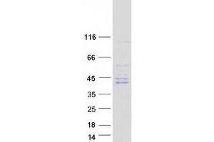 Validation with Western Blot (NEK6 Protein (Transcript Variant 1) (Myc-DYKDDDDK Tag))