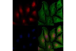 ABIN7093620 and ABIN7097645 staining  cells by IF/ICC. (WEE1 抗体)