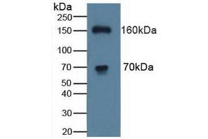Detection of ATP7b in Human K562 Cells using Polyclonal Antibody to ATPase, Cu++ Transporting Beta Polypeptide (ATP7b) (ATP7B 抗体  (AA 59-426))