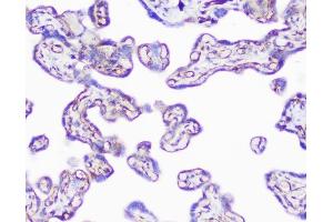 IHC analysis of INPPL1 using anti-INPPL1 antibody (ABIN6719492). (INPPL1 抗体  (AA 1172-1258))