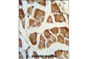Immunohistochemistry (Paraffin-embedded Sections) (IHC (p)) image for anti-Tafazzin (TAZ) (AA 32-60), (N-Term) antibody (ABIN652751)