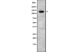 Western blot analysis of HIPK2 using 293 whole  lysates. (HIPK2 抗体  (N-Term))