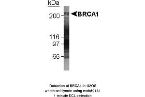 Image no. 1 for anti-Breast Cancer 1 (BRCA1) (AA 1314-1600), (AA 1314-1864) antibody (ABIN363285) (BRCA1 抗体  (AA 1314-1600, AA 1314-1864))