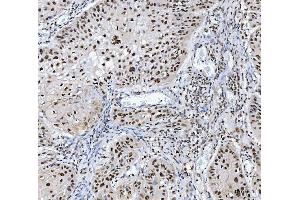 IHC analysis of MBNL1 using anti-MBNL1 antibody (ABIN7602608).