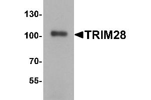 Western Blotting (WB) image for anti-Tripartite Motif Containing 28 (TRIM28) (C-Term) antibody (ABIN1077358) (KAP1 抗体  (C-Term))