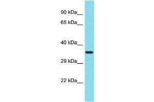 Host: Rabbit Target Name: SIAH3 Sample Type: MCF7 Whole Cell lysates Antibody Dilution: 1. (SIAH3 抗体  (C-Term))