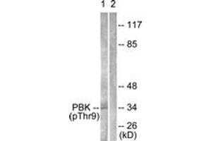 Western blot analysis of extracts from K562 cells treated with UV 30', using PBK/TOPK (Phospho-Thr9) Antibody. (PBK 抗体  (pThr9))