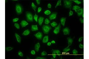 Immunofluorescence of monoclonal antibody to TUBB4B on HeLa cell. (TUBB2C 抗体  (AA 1-445))