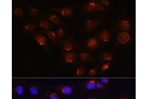 Immunofluorescence analysis of C6 cells using GOLGA4 Polyclonal Antibody at dilution of 1:100 (40x lens). (GOLGA4 抗体)