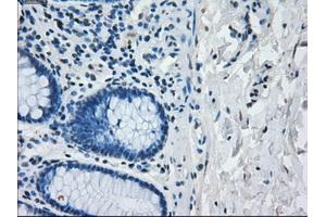 Image no. 1 for anti-Interferon Regulatory Factor 3 (IRF3) antibody (ABIN1498899)