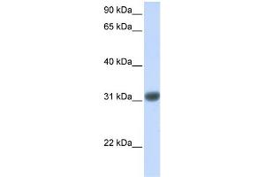 WB Suggested Anti-OTX2 Antibody Titration: 0. (OTX2 抗体  (Middle Region))