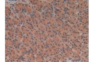 Detection of TUBd in Rat Stomach Tissue using Polyclonal Antibody to Tubulin Delta (TUBd) (TUBD1 抗体  (AA 238-482))