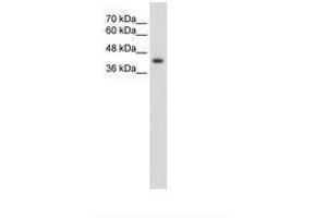 Image no. 3 for anti-GNAS Complex Locus (GNAS) (AA 51-100) antibody (ABIN203445) (GNAS 抗体  (AA 51-100))