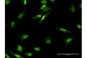 Immunofluorescence of purified MaxPab antibody to MPHOSPH8 on HeLa cell. (MPHOSPH8 抗体  (AA 1-259))