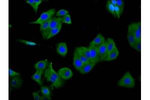 Immunofluorescence staining of HepG2 cells with ABIN7153555 at 1:166, counter-stained with DAPI. (SGCG 抗体  (AA 108-221))