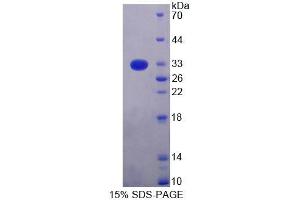 SDS-PAGE analysis of Rat TOP1MT Protein. (TOP1MT 蛋白)