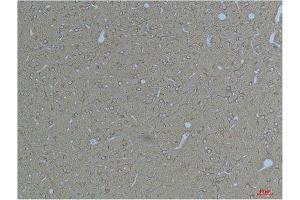 Immunohistochemistry (IHC) image for anti-Potassium Voltage-Gated Channel, Subfamily H (Eag-Related), Member 7 (KCNH7) antibody (ABIN3188071)