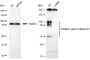 Western blotting analysis using interferon gamma receptor 1 antibody (ABIN7799082).