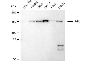 Western blotting analysis using AGL antibody (ABIN7797592). (Recombinant AGL 抗体)