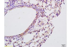 Formalin-fixed and paraffin embedded mouse lung labeled with Anti-IL-9 Polyclonal Antibody, Unconjugated (ABIN740130) at 1:200 followed by conjugation to the secondary antibody and DAB staining (IL-9 抗体  (AA 21-120))
