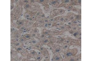 Used in DAB staining on fromalin fixed paraffin- embedded liver tissue (OSTM1 抗体  (AA 120-251))