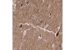 Immunohistochemical staining of human cerebral cortex with ACOT4 polyclonal antibody  shows strong cytoplasmic and nuclear positivity in neuronal cells. (ACOT4 抗体)