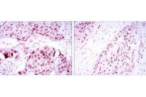 Immunohistochemistry (IHC) image for anti-SRY (Sex Determining Region Y)-Box 2 (SOX2) antibody (ABIN969414)