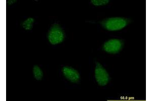 Immunofluorescence of monoclonal antibody to APCS on HeLa cell. (APCS 抗体  (AA 35-149))