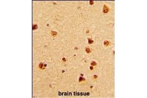 Immunohistochemistry (Paraffin-embedded Sections) (IHC (p)) image for anti-KH-Type Splicing Regulatory Protein (KHSRP) (AA 94-122), (N-Term) antibody (ABIN390852)