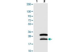 Western blot analysis of Lane 1: Negative control (vector only transfected HEK293T lysate). (SNRNP27 抗体)