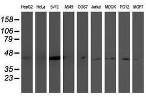 Image no. 2 for anti-NudE Nuclear Distribution E Homolog (A. Nidulans)-Like 1 (NDEL1) antibody (ABIN1499855) (NDEL1 抗体)